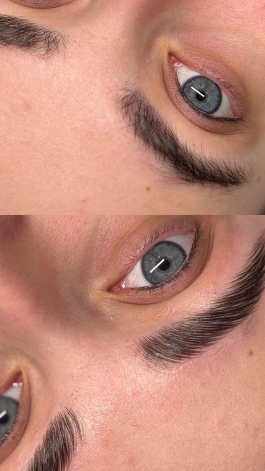Brow lift +farbanje obrva+ botox (nega) - Esthetique Privé, Beograd Obrve Lice Obrve, Beograd, Centar, Stari grad, Dorćol