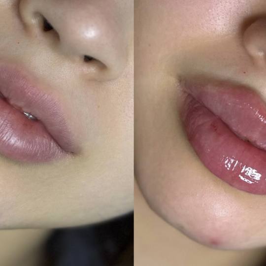 Estetik beauty centar usluga