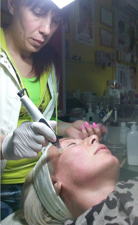 Mon cheri Anđela #beograd Dermaroler i dermapen