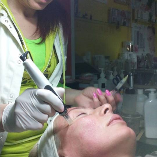 Mon cheri Anđela #beograd Dermaroler i dermapen