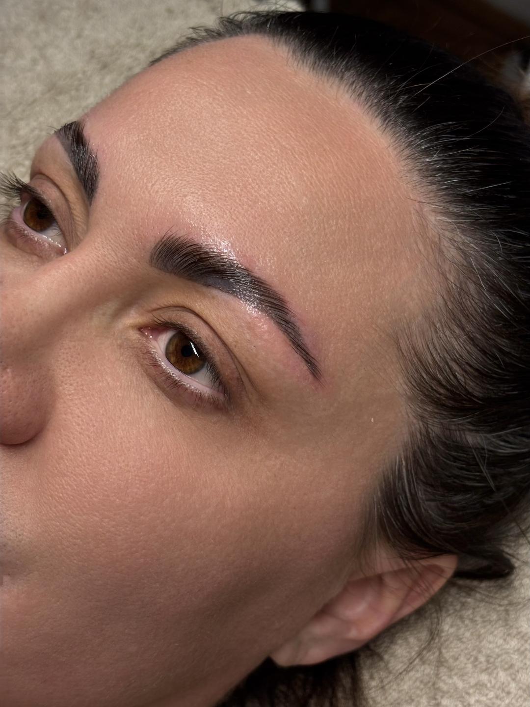 Brow lift - Aora, Novi Sad Obrve Lice Obrve, Novi Sad, Centar - Stari grad