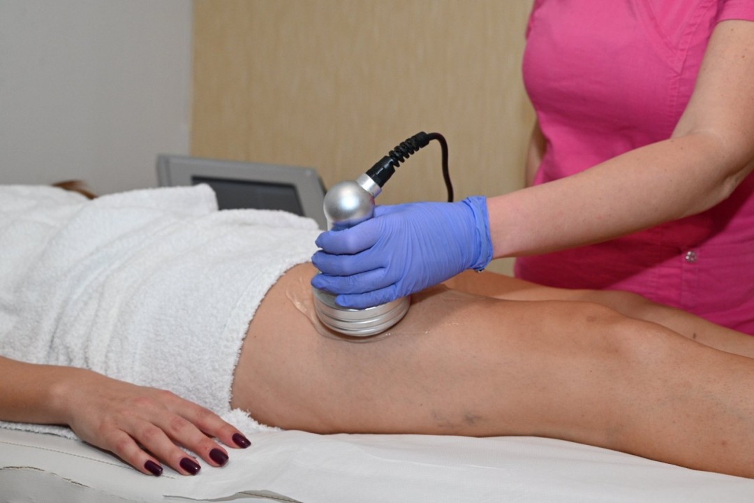 Estetik Slim Studio #beograd Kavitacija Kavitacija - po regiji