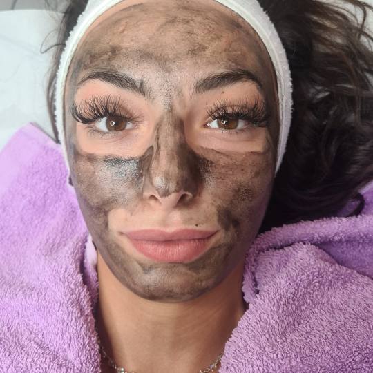 Laser centar Delight #beograd Piling lica Tretman lica karbon pilom Dubinsko ciscenje lica,karbon pa