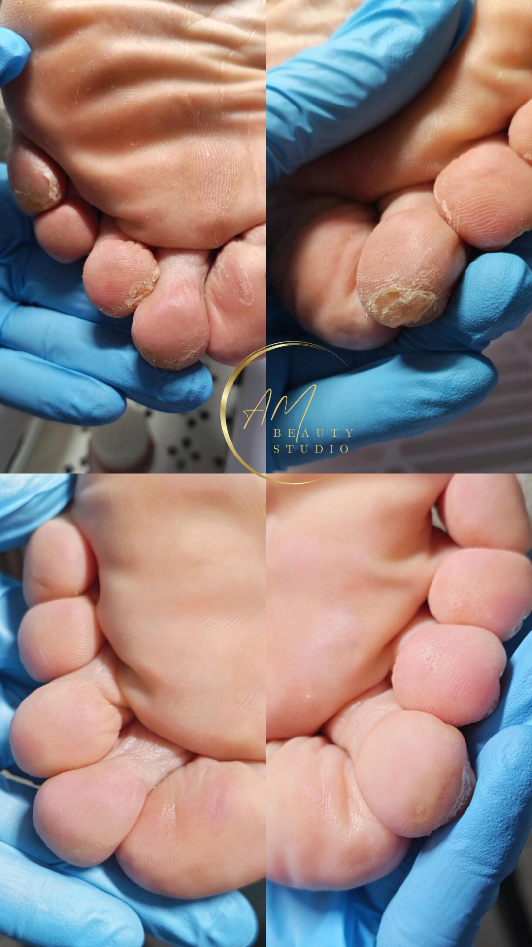 AM BEAUTY STUDIO #odzaci Tretmani tela Aparatni pedikir