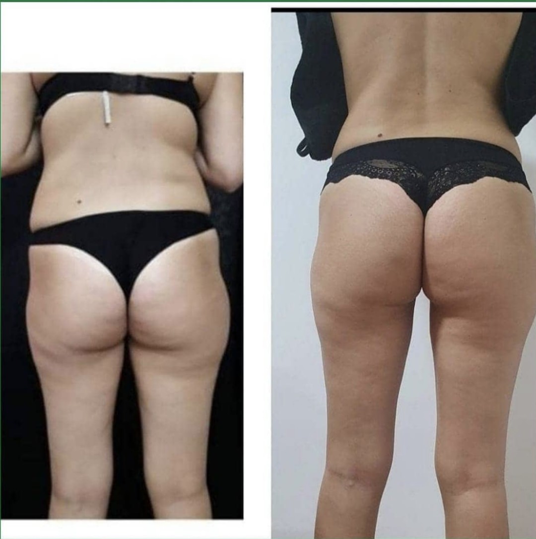 Kombinovana masaža - Zgodnica, Beograd Opšta masaža Masaža Opšta masaža, Beograd, Jajinci