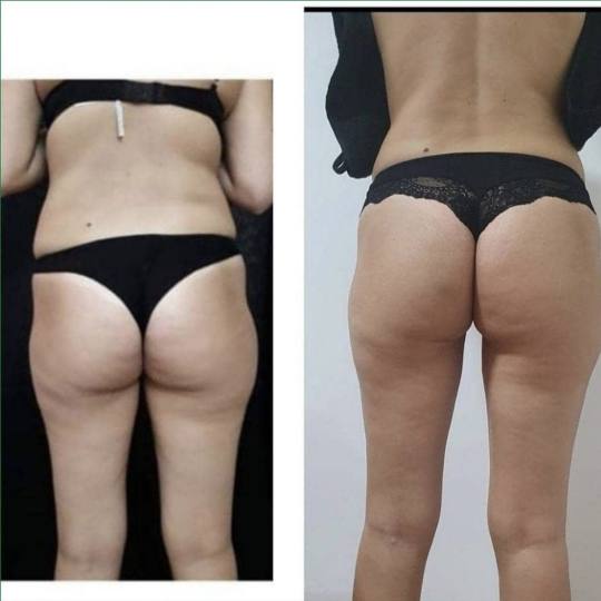 Zgodnica #beograd Opšta masaža Kombinovana masaža Ovaj paket je namenjen ženama koje žele vidlj