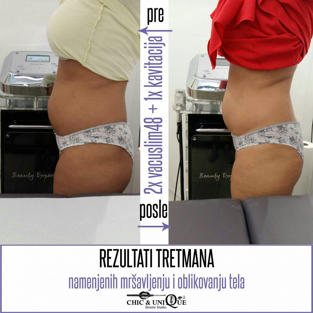 Chic & Unique #beograd Tretmani tela