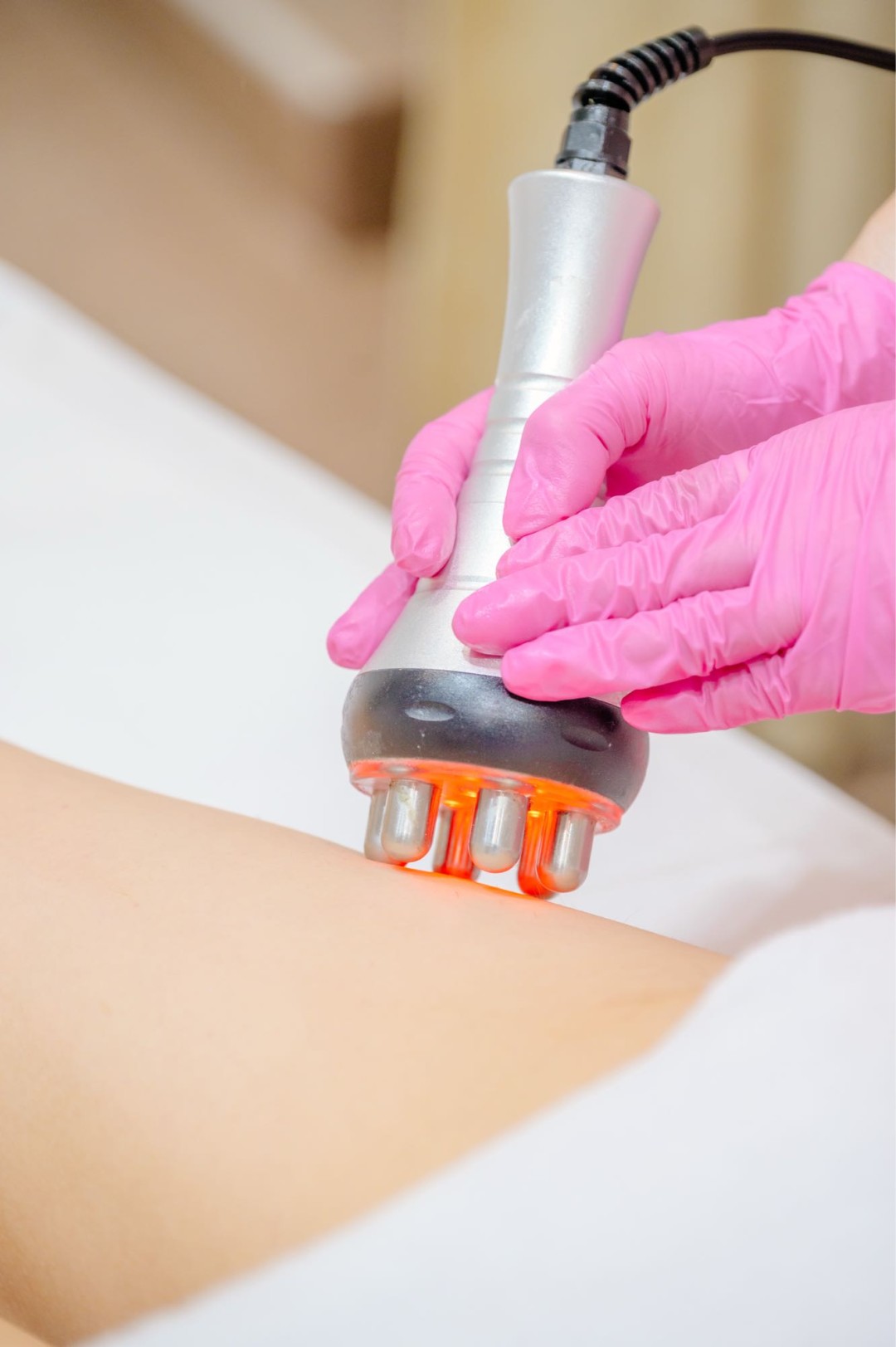 Happy Lady #beograd Anticelulit Body contour - tretman za uklanjanje masti + celulita