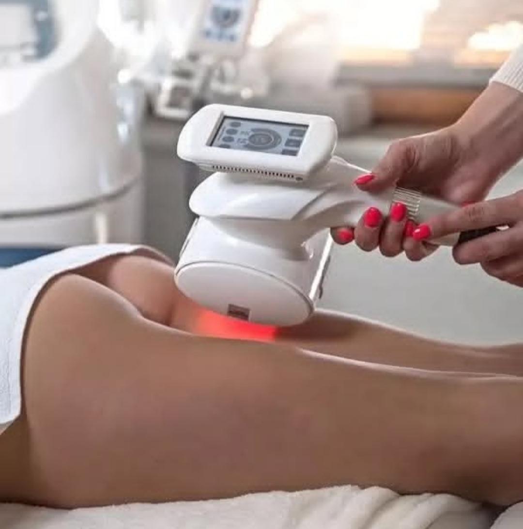 Professional beauty and spa #beograd Laserska epilacija Laserska epilacija paket 6 tretmana noge i prepone akcija