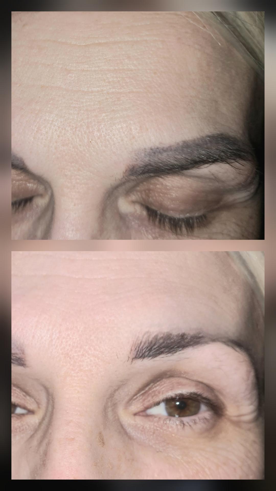 Laser centar Delight #beograd Laserski tretmani lica 3 tretmana uklanjanja trajne sminke