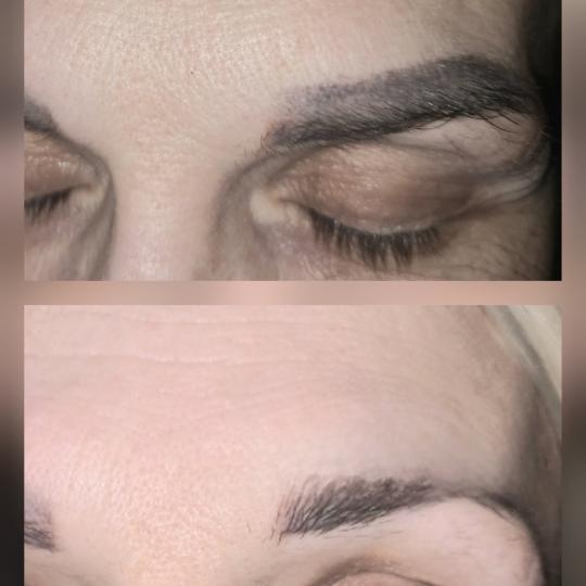 Laser centar Delight usluga