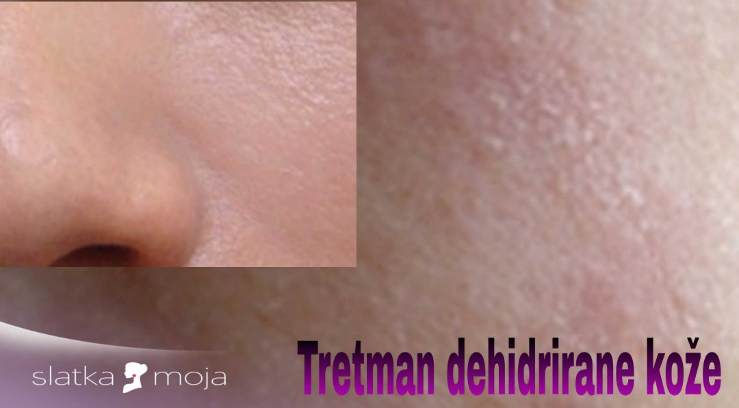 Biološki tretman lica - relaks + nega - Slatka moja, Beograd Tretman lica Lice Tretman lica, Beograd, Novi Beograd blokovi, Belville, Savski kej