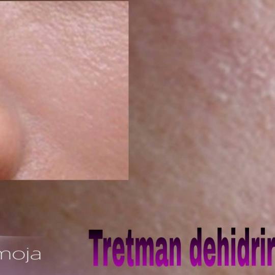 Slatka moja #beograd Tretman lica Biološki tretman lica - relaks + nega hidratacija hijaluronom deh